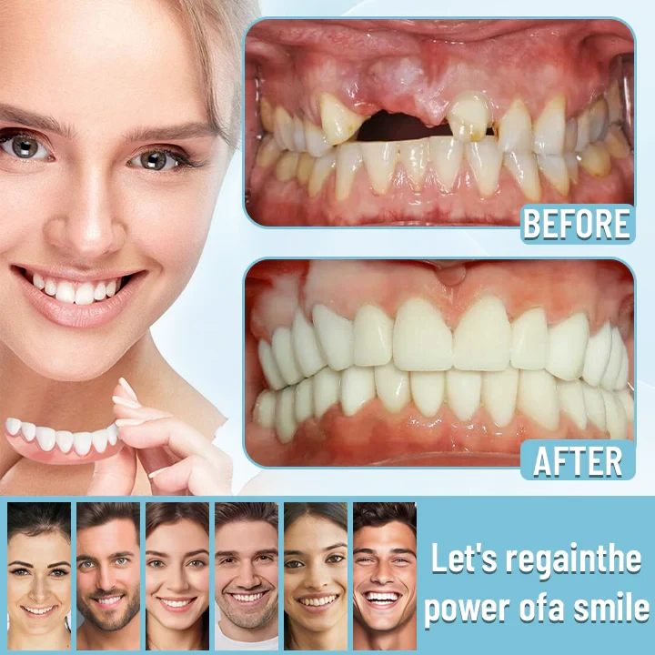 【Bikenda® Official Store】🦷Advanced Full Denture Set