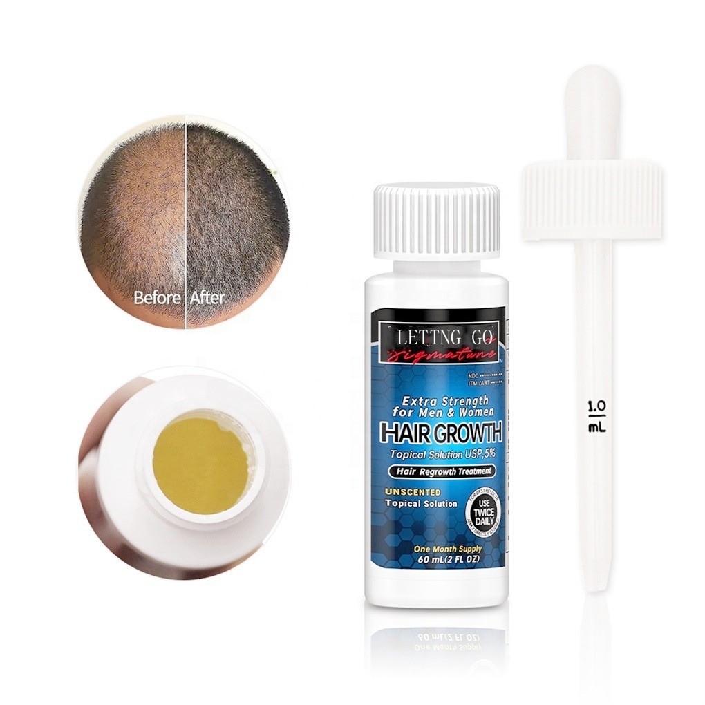 Thick And Fluffy Hairline