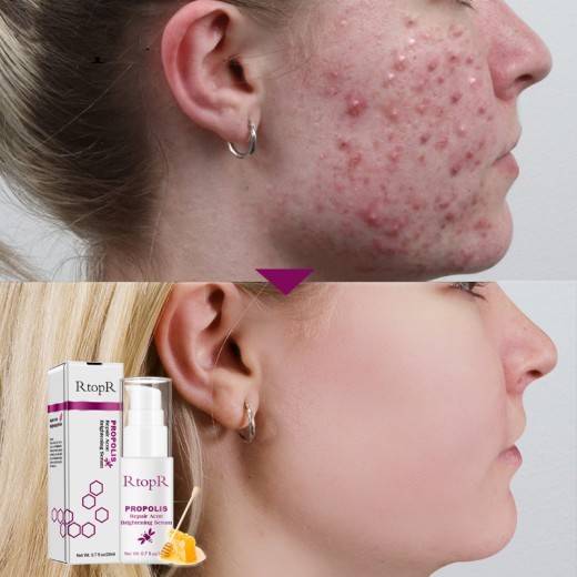 Light Licorice Pore Liquid Product AliExpress Supply