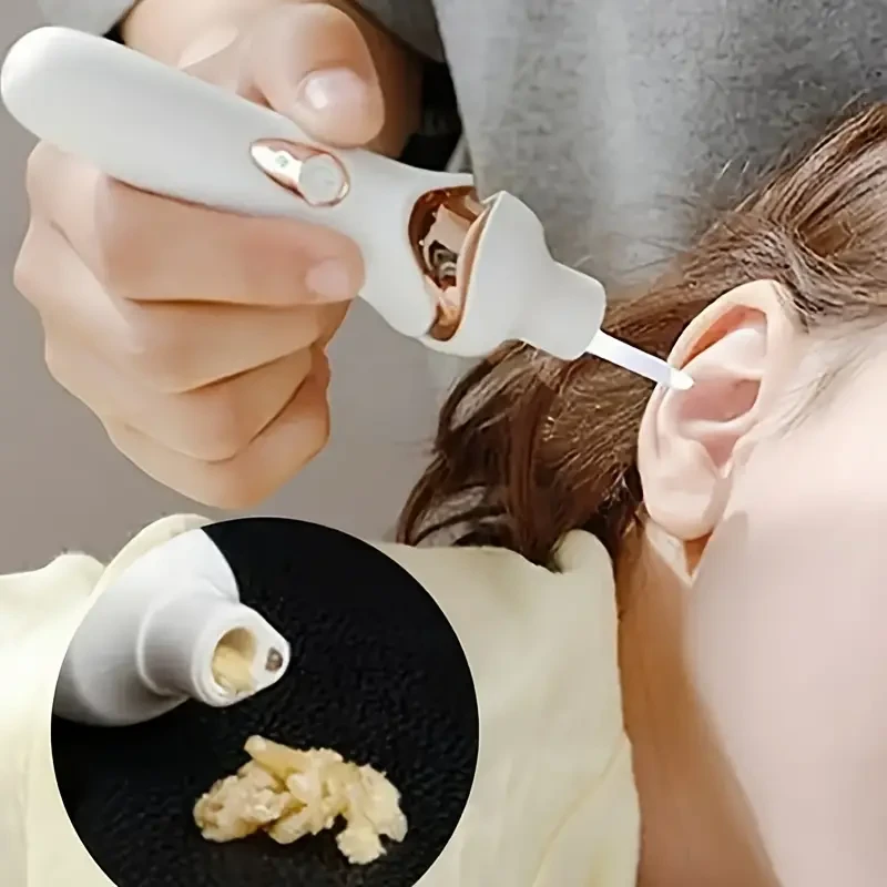 ProEar Cleaner - Illuminated Ear Wax Removal Tool with Suction & Digging Functions, Rechargeable & Portable with LED Light