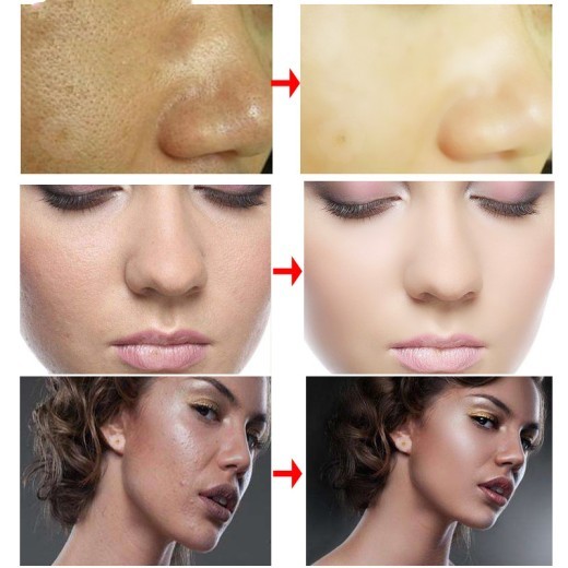 RtopR Cream RtopR001