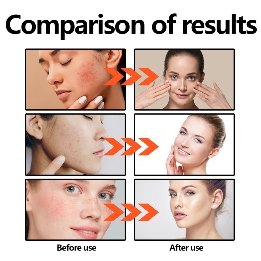 Gentle Exfoliating Lotion Glossy Refreshing Skin Repair