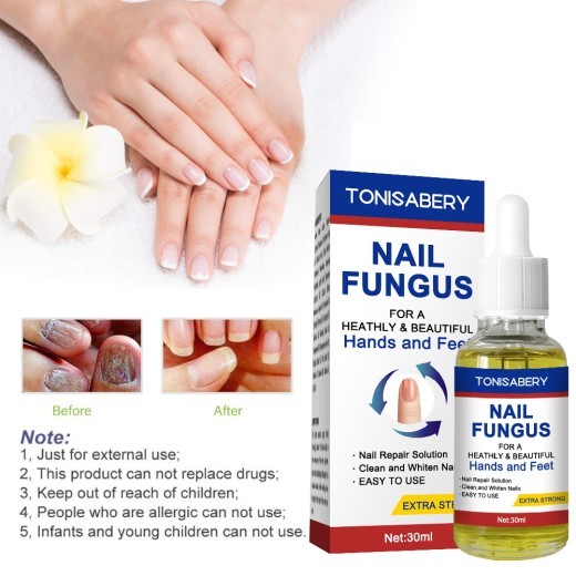 Nail To Remove Nails30 Ml