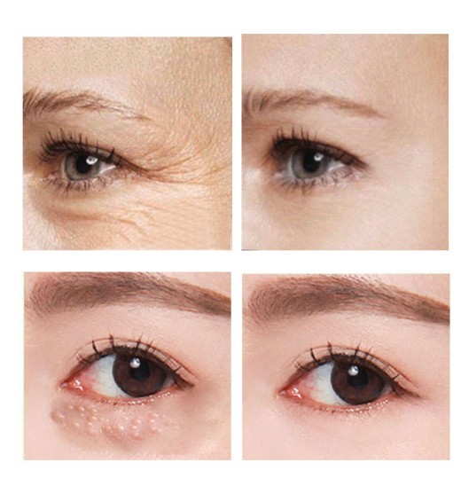 Cross-Border Vova Wrinkle Reduction Eye Cream, Fat Particles To Reduce Dark Eyes And Fine Lines, Eye Bags And Eye Cream
