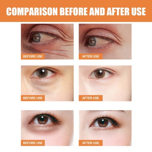 , anti-aging eye cream, eye care with vitamin C, rejuvenating eye cream, revitalizing eye care