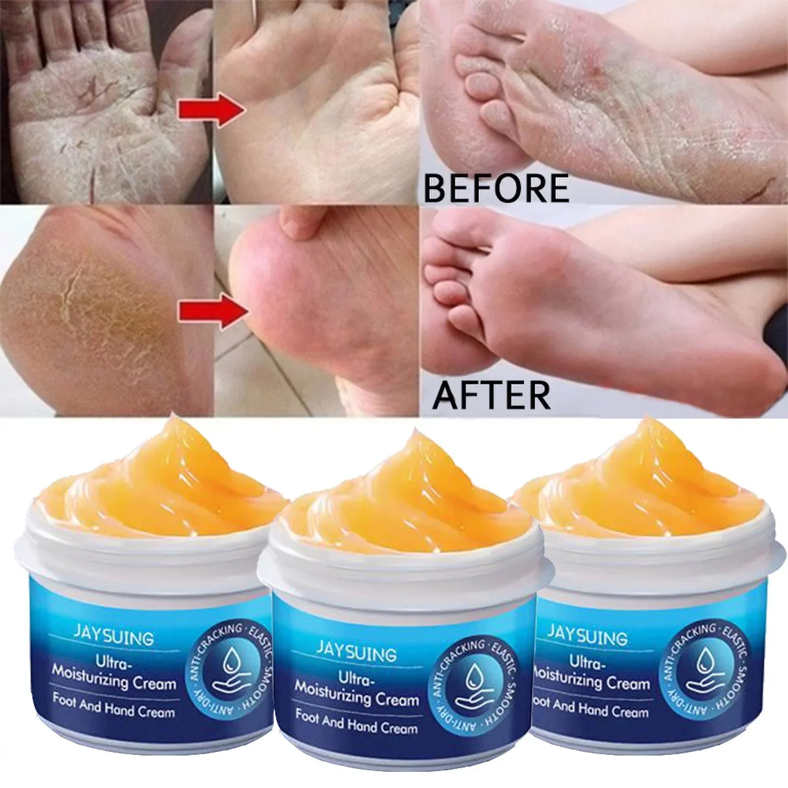 Anti-Drying Crack Hand and Foot Care Cream