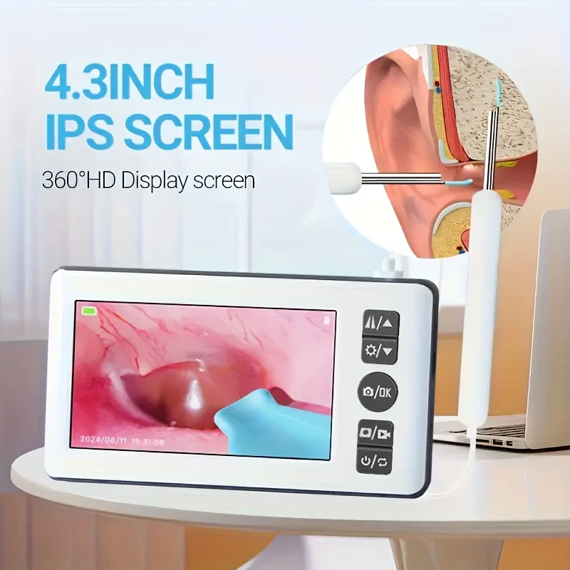 HD 3.5mm Camera Ear Cleaning Tool with 4.3" IPS Screen