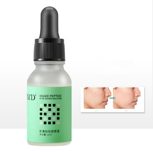 Facial Acne Repair Shrink Pores Moisturizing