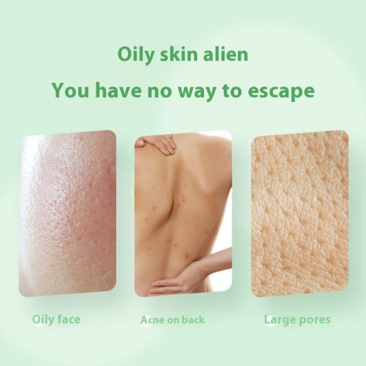 Kojic Acid Handmade Soap Oil Control Brightening