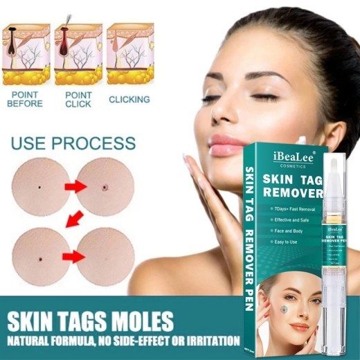 Wart Flat Especially AcutenessKe You Cream Smooth Liquid