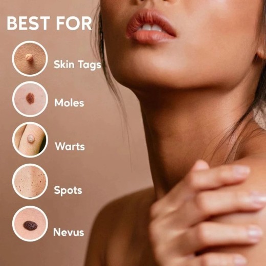 Wart Flat Especially AcutenessKe You Cream Smooth Liquid
