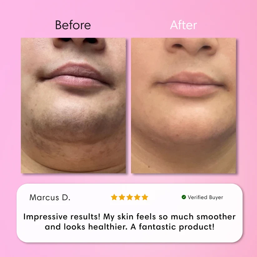 Instant Hair Removal Kit