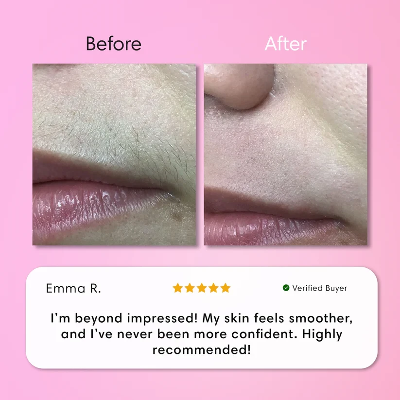 Instant Hair Removal Kit