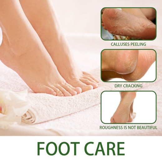 Foot Heel Calluses Crack Exfoliating Skin Care Solution
