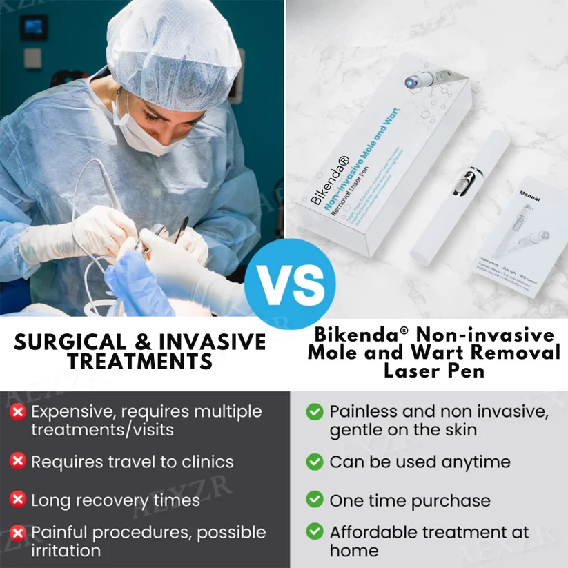 Bikenda Non-Invasive Mole and Wart Removal Laser Pen