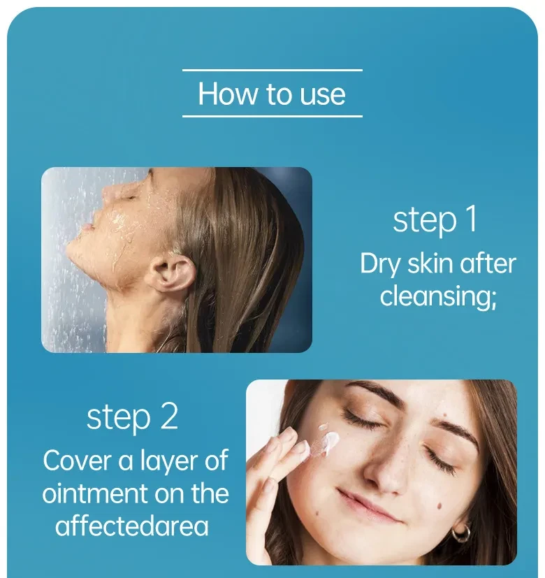 Bedsore Cream Body Moisturizing Cream 20g