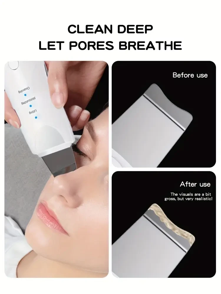 Light Beige Scrubber - 3 Modes Facial Cleansing Spatula, Exfoliating Brush